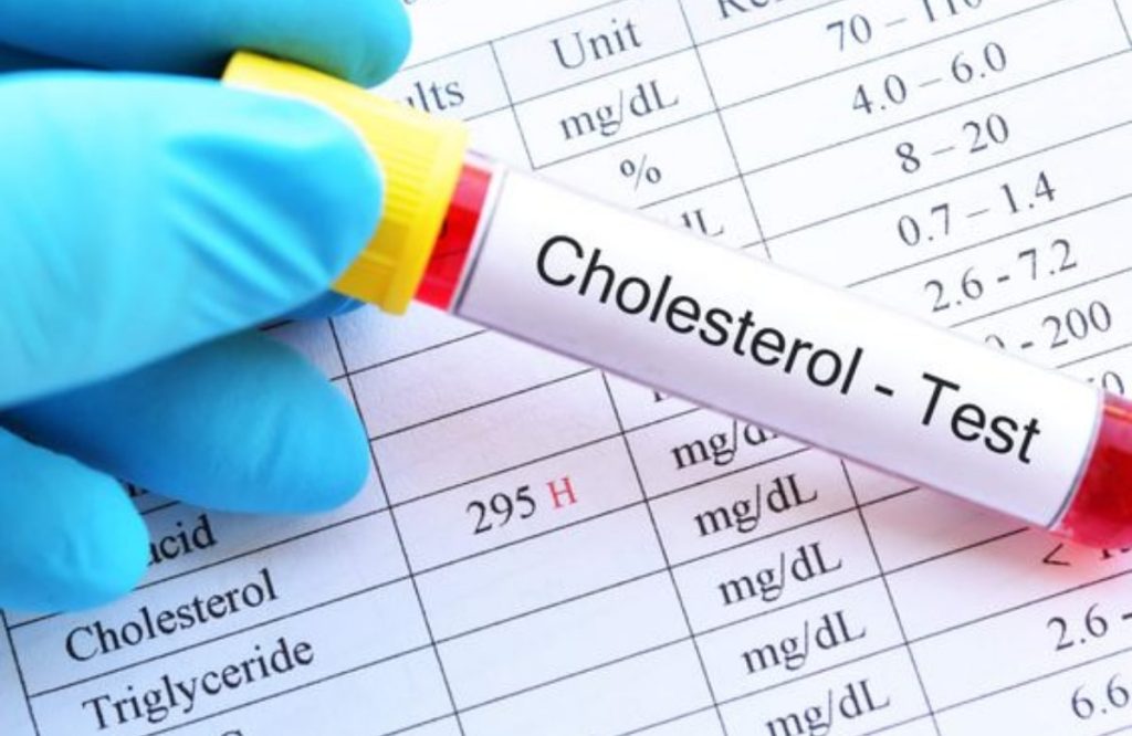 Tips To Avoid Cholestrol