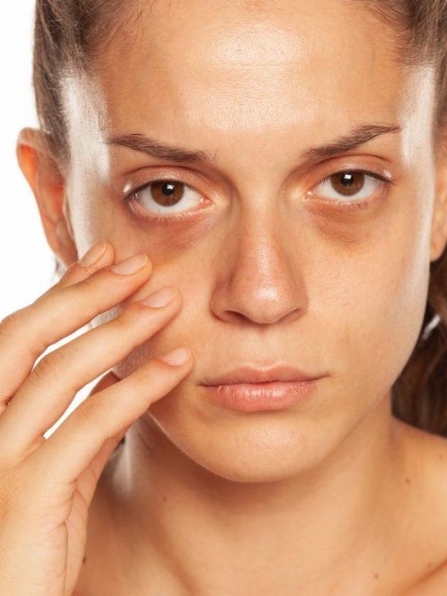 home remedies To get rid of under eye darkness