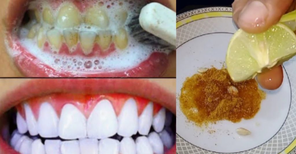 teeth-2